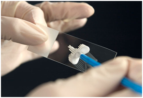 PAP-teszt a HPV-fertőzés